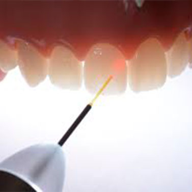 laser dentistry